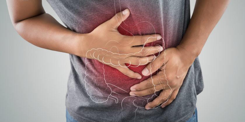 Colon irritable Dr. Xavier Obando Coloproctólogo Quito